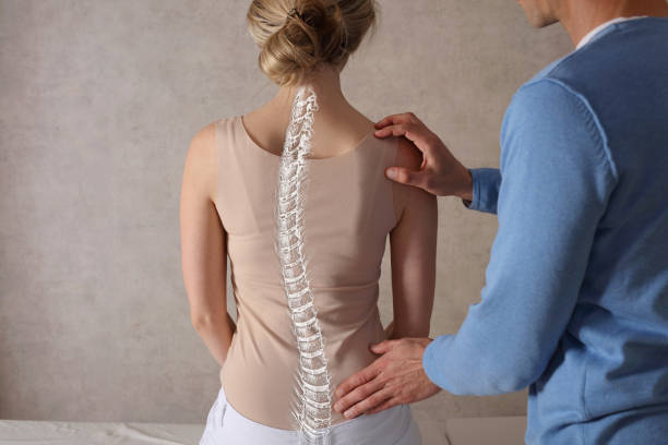 Escoliosis