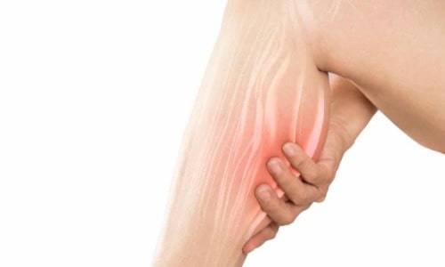 Contractura Muscular